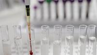 Test scientifique en laboratoire.